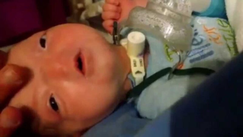 「完全先天性無音症」の赤ちゃんです。